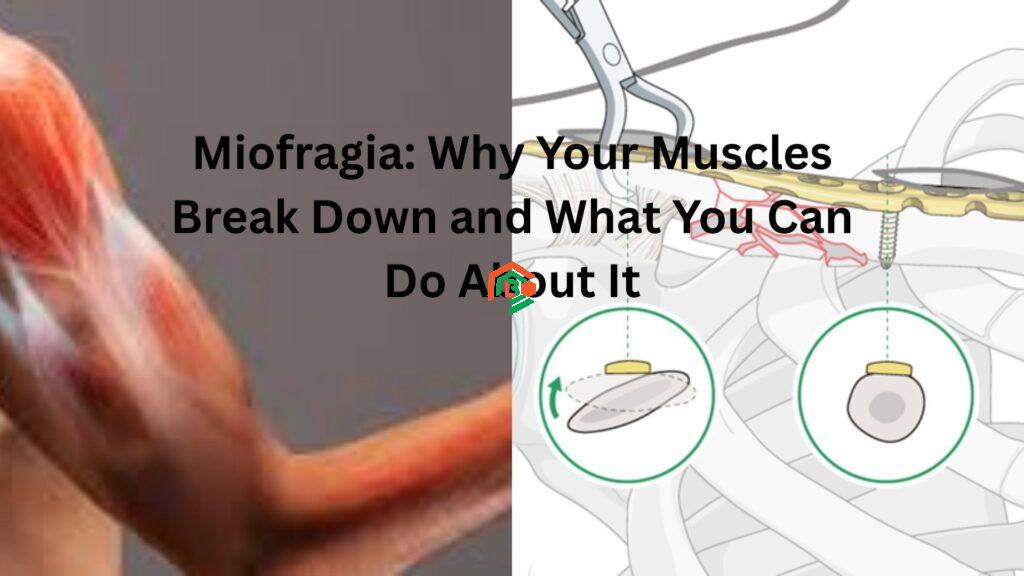 Miofragia: Why Your Muscles Break Down and What You Can Do About It miofragia